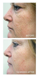 AGE REVERSE SYSTEM - TRAVEL SIZE