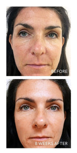 AGE REVERSE SYSTEM - TRAVEL SIZE