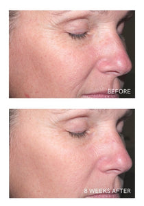 AGE REVERSE SYSTEM - TRAVEL SIZE