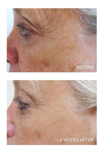 SKIN BRIGHTENING SYSTEM